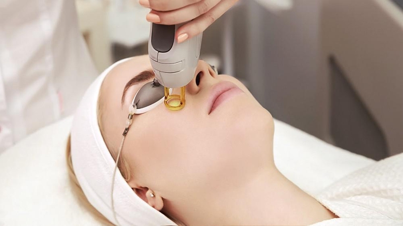 Types of Laser Facial Treatment in Dubai