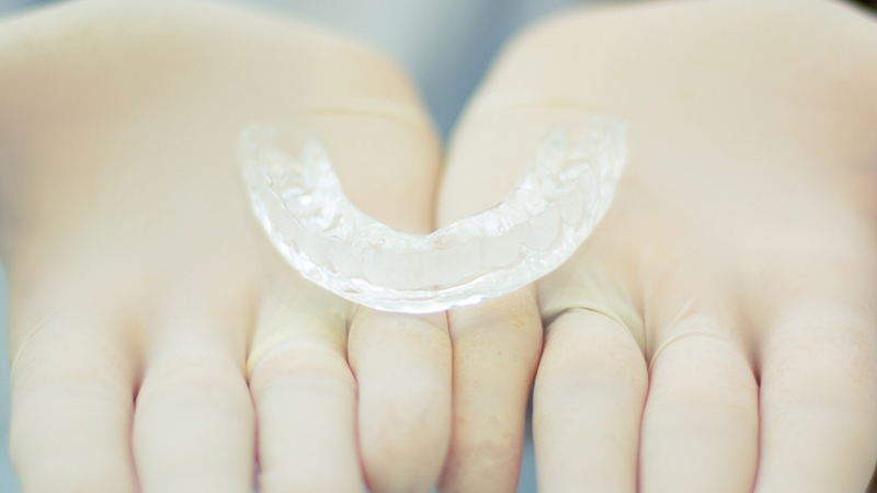 How do aligners function?