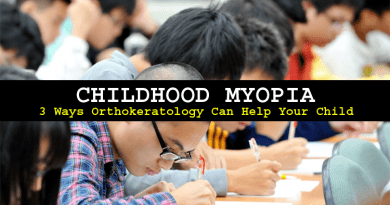 Childhoot Myopia